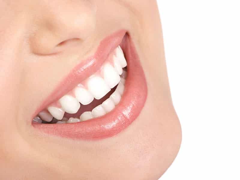 Remedios caseros para blanquear los dientes