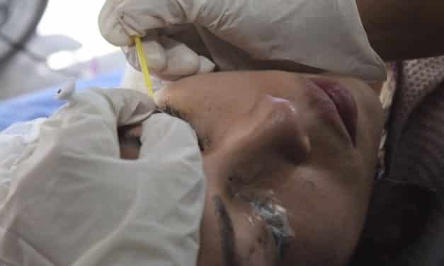 Diferencias entre micropigmentación y microblading