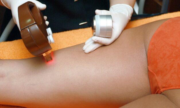 Lo que debes saber antes de comprar una depiladora de luz pulsada