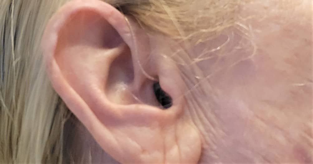 Audífonos invisibles, lo que debes saber